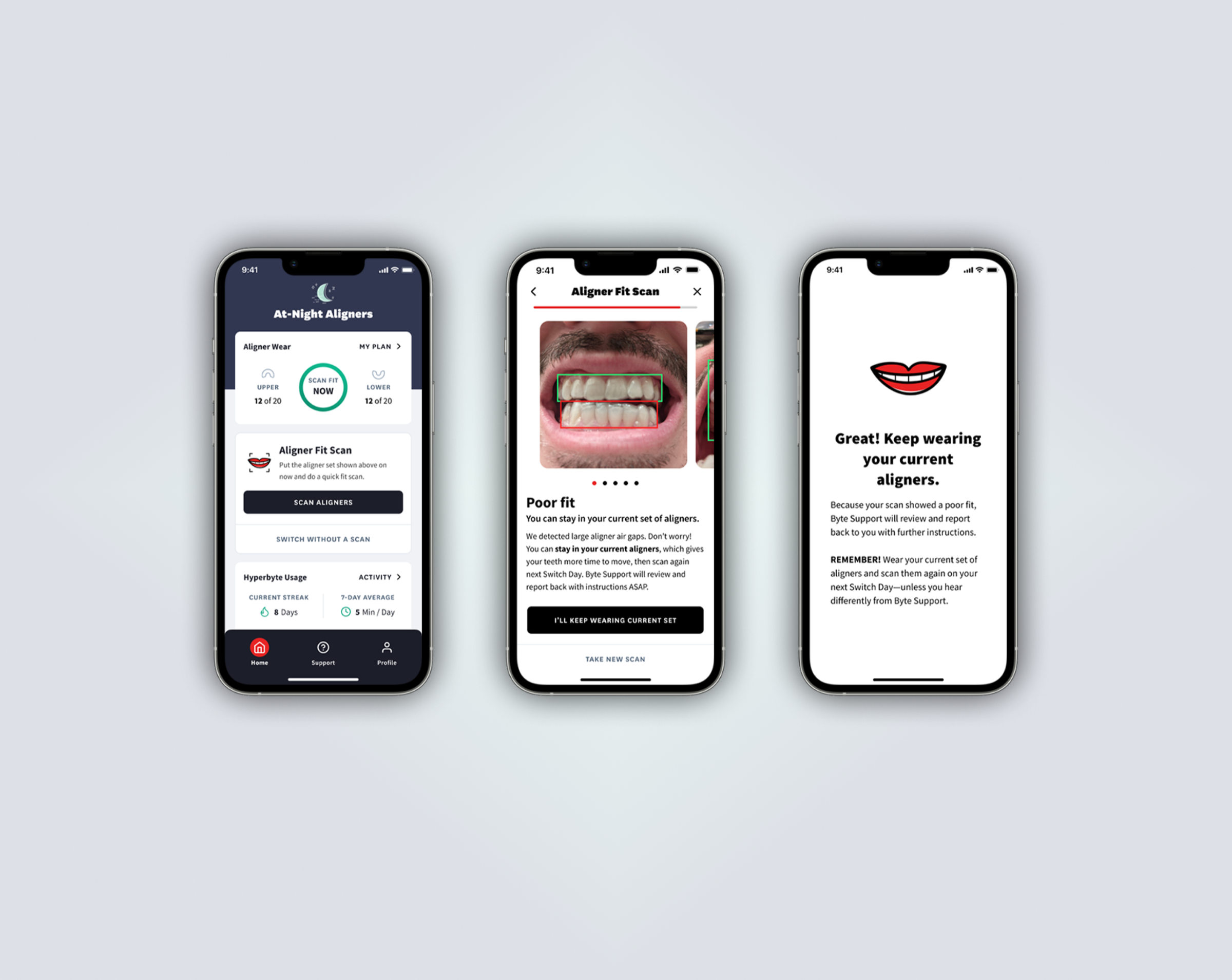 Byte AI Aligner Fit Scan product interface