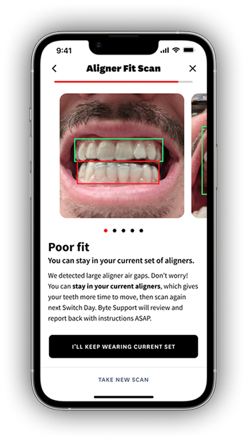AI Aligner Fit Scan experience